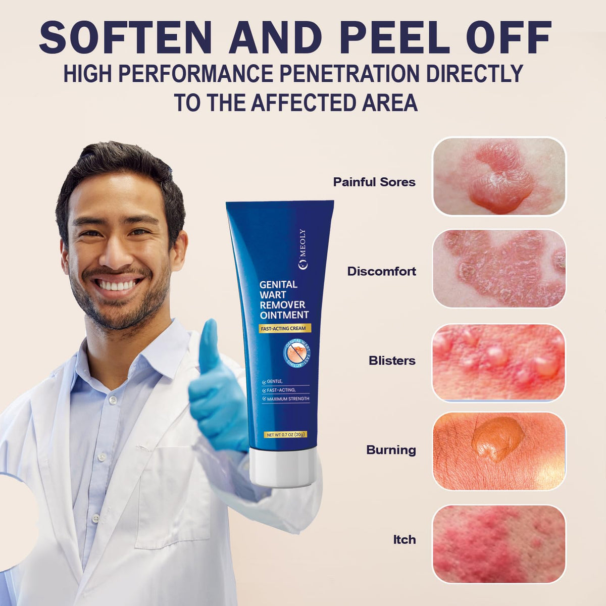 Genital Wart Remover Cream 0.7 oz B2808