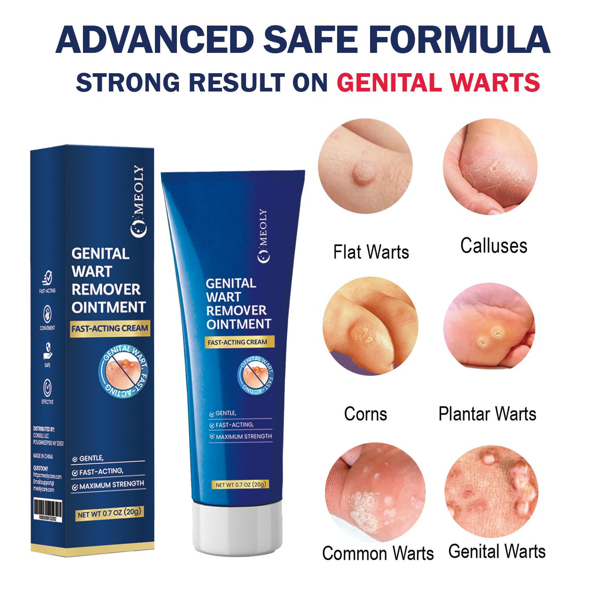 Genital Wart Remover Cream 0.7 oz B2808